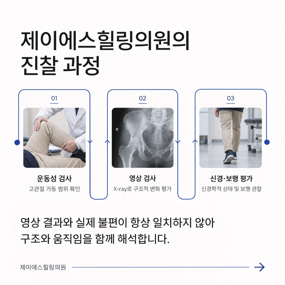 고관절 통증 진료에서 살피는 가동범위·영상·신경과 보행