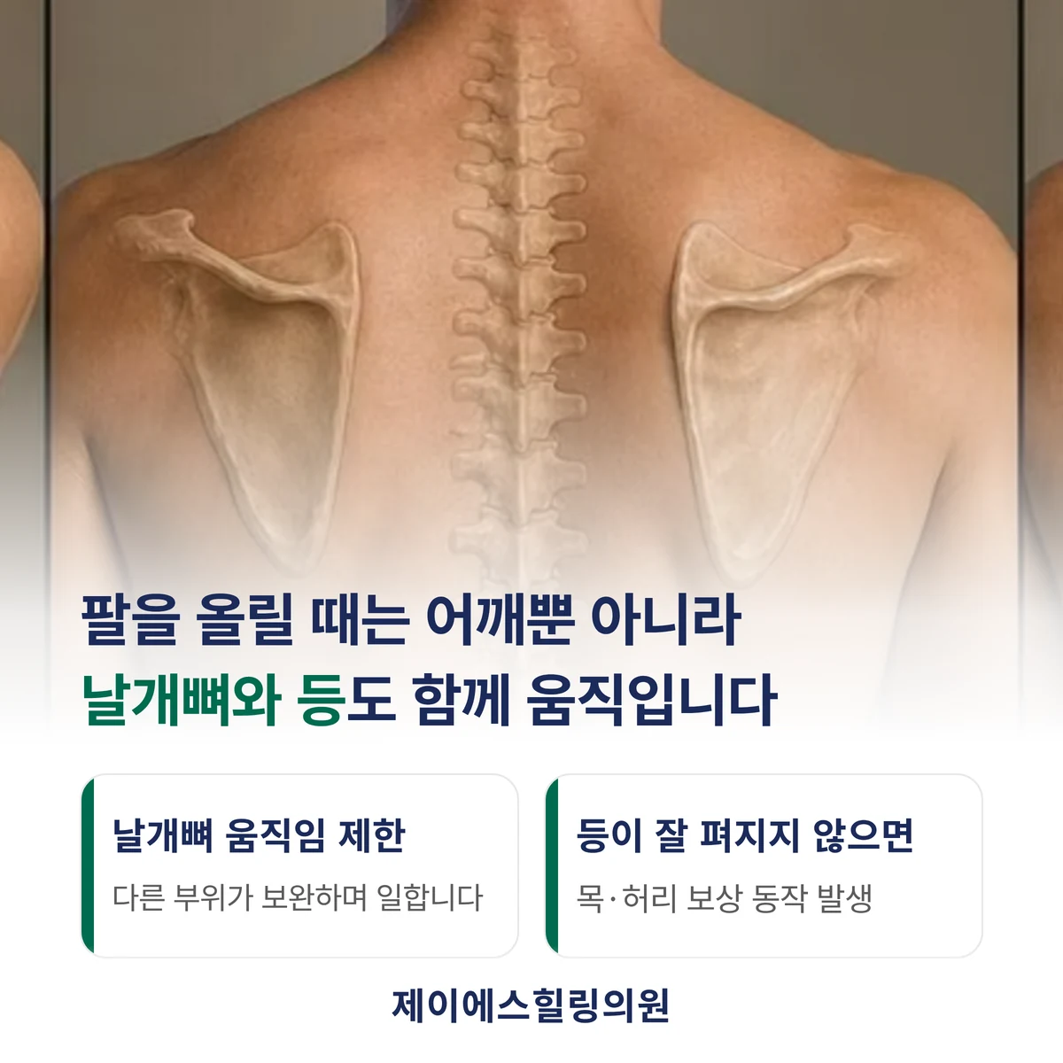 팔을 올릴 때는 어깨관절과 날개뼈, 등이 함께 움직입니다