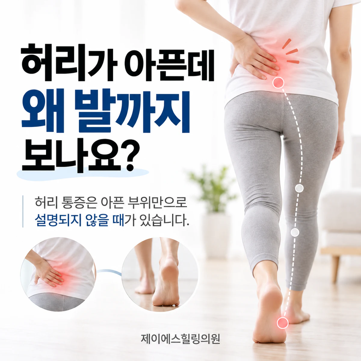 허리통증은 아픈 부위만으로 설명되지 않을 수 있음을 보여주는 이미지