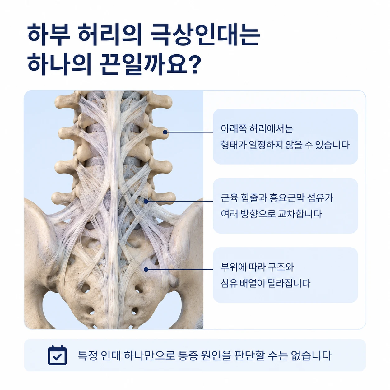 하부 요추에서 근육 힘줄과 흉요근막 섬유가 교차하는 모습