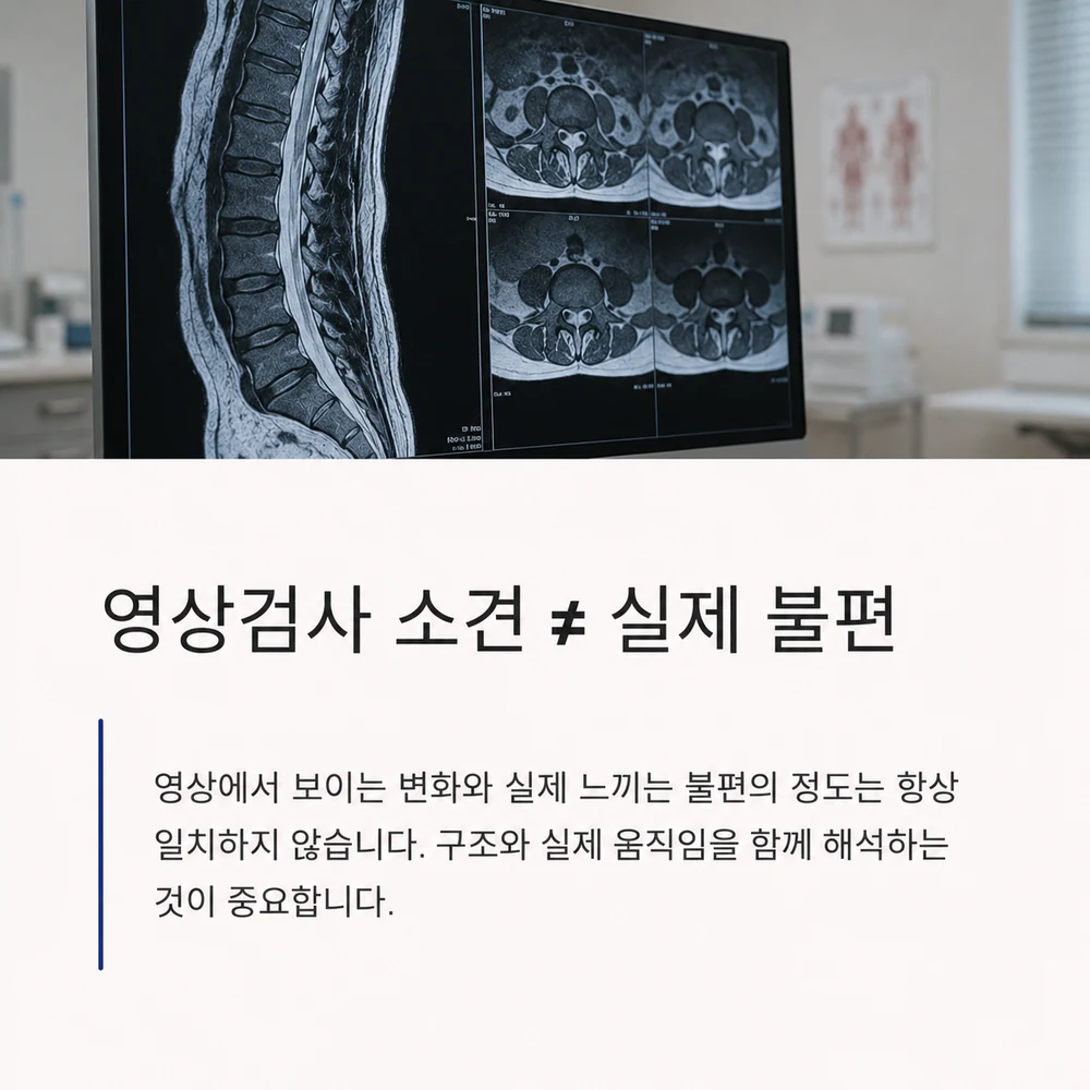 허리 영상검사 소견과 실제 불편이 항상 같지는 않다는 설명