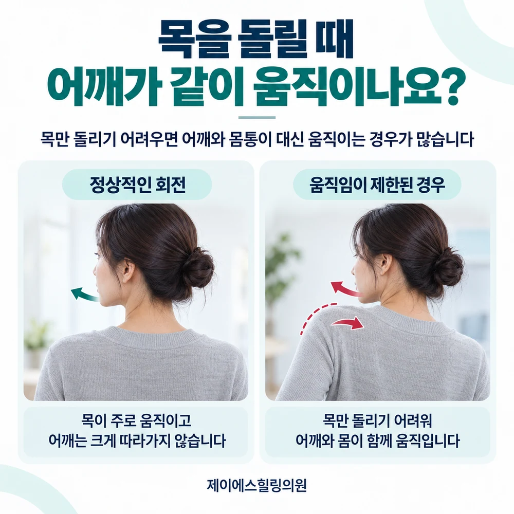 목을 돌릴 때 어깨와 몸통이 대신 움직이는 경우